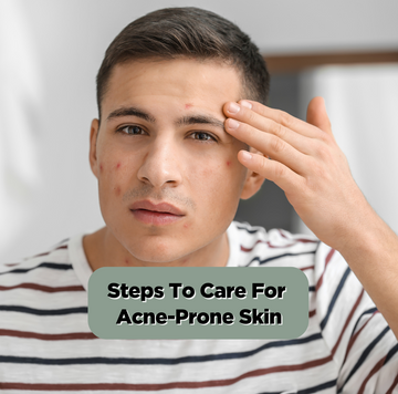 Steps To Care For Acne-Prone Skin
