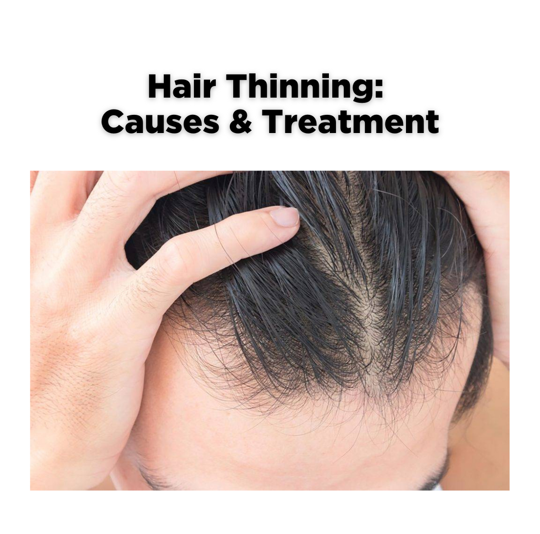 Thinning Hair - Causes and Treatment